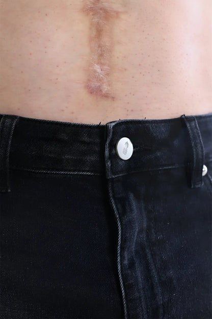 A subtle pineapple design white button fastened on dark denim cheeky summer 2.5 inch brief shorts black